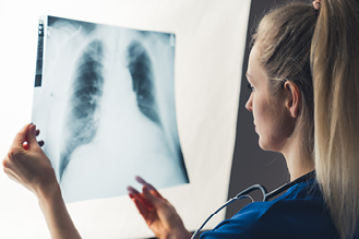 A nurse examines an x-ray photograph of human lungs